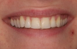Smile Gallery - Church Road Dental and Cosmetic
