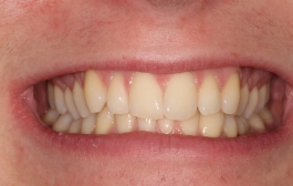 Smile Gallery - Church Road Dental and Cosmetic