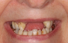 Smile Gallery - Church Road Dental and Cosmetic