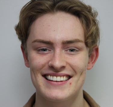 Smile Gallery - Church Road Dental and Cosmetic