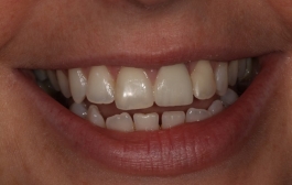 Smile Gallery - Church Road Dental and Cosmetic
