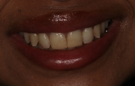 Smile Gallery - Church Road Dental and Cosmetic