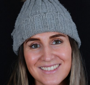 Smile Gallery - Church Road Dental and Cosmetic