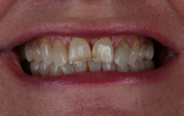 Smile Gallery - Church Road Dental and Cosmetic