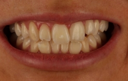 Smile Gallery - Church Road Dental and Cosmetic