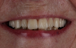 Smile Gallery - Church Road Dental and Cosmetic