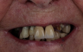 Smile Gallery - Church Road Dental and Cosmetic