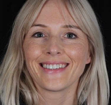 Smile Gallery - Church Road Dental and Cosmetic