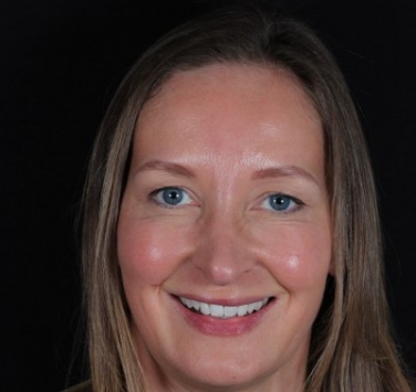 Smile Gallery - Church Road Dental and Cosmetic