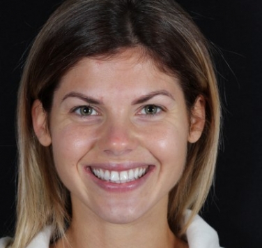 Smile Gallery - Church Road Dental and Cosmetic