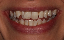 Smile Gallery - Church Road Dental and Cosmetic