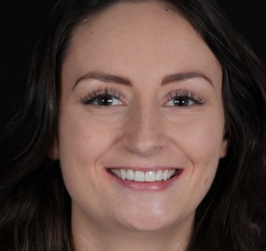 Smile Gallery - Church Road Dental and Cosmetic