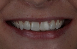 Smile Gallery - Church Road Dental and Cosmetic