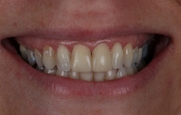 Smile Gallery - Church Road Dental and Cosmetic
