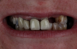 Smile Gallery - Church Road Dental and Cosmetic