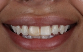 Smile Gallery - Church Road Dental and Cosmetic
