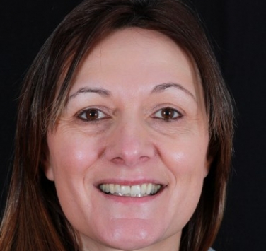 Smile Gallery - Church Road Dental and Cosmetic