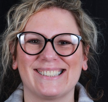 Smile Gallery - Church Road Dental and Cosmetic