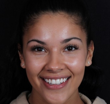 Smile Gallery - Church Road Dental and Cosmetic