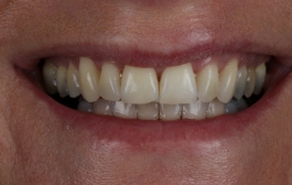 Smile Gallery - Church Road Dental and Cosmetic