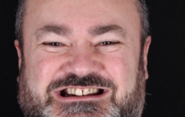 Smile Gallery - Church Road Dental and Cosmetic