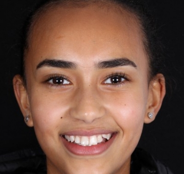 Smile Gallery - Church Road Dental and Cosmetic