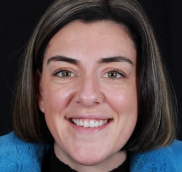 Smile Gallery - Church Road Dental and Cosmetic