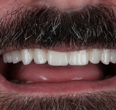 Smile Gallery - Church Road Dental and Cosmetic