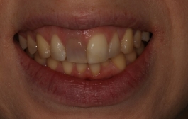Smile Gallery - Church Road Dental and Cosmetic