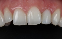 Smile Gallery - Church Road Dental and Cosmetic