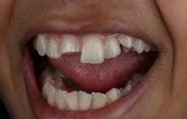 Smile Gallery - Church Road Dental and Cosmetic