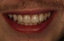 Smile Gallery - Church Road Dental and Cosmetic
