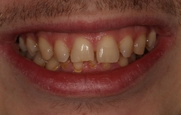 Smile Gallery - Church Road Dental and Cosmetic
