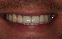 Smile Gallery - Church Road Dental and Cosmetic