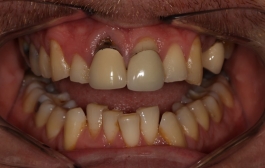 Smile Gallery - Church Road Dental and Cosmetic