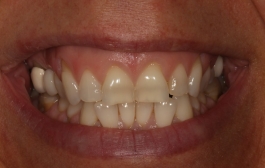 Smile Gallery - Church Road Dental and Cosmetic