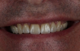 Smile Gallery - Church Road Dental and Cosmetic