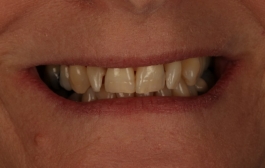 Smile Gallery - Church Road Dental and Cosmetic