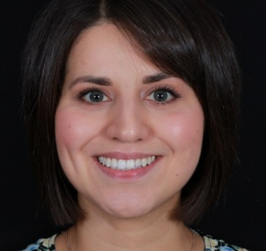 Smile Gallery - Church Road Dental and Cosmetic
