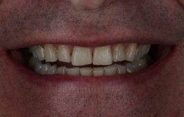 Smile Gallery - Church Road Dental and Cosmetic