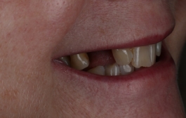 Smile Gallery - Church Road Dental and Cosmetic