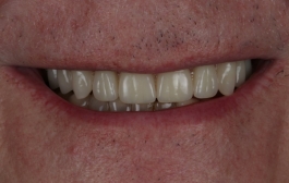 Smile Gallery - Church Road Dental and Cosmetic