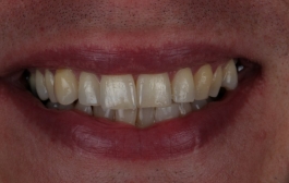 Smile Gallery - Church Road Dental and Cosmetic