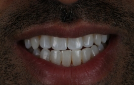 Smile Gallery - Church Road Dental and Cosmetic