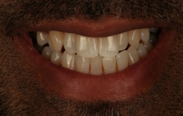 Smile Gallery - Church Road Dental and Cosmetic