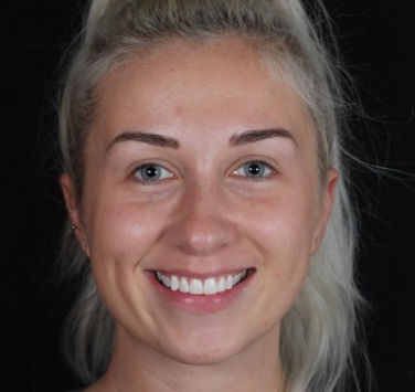 Smile Gallery - Church Road Dental and Cosmetic