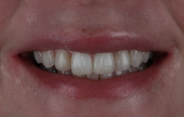 Smile Gallery - Church Road Dental and Cosmetic