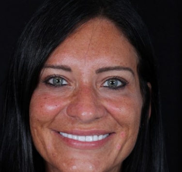 Smile Gallery - Church Road Dental and Cosmetic