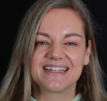 Smile Gallery - Church Road Dental and Cosmetic
