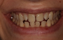 Smile Gallery - Church Road Dental and Cosmetic